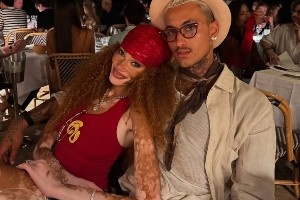 库兹马晒与白癜风未婚妻甜蜜合照❤️ 两人在法国度假